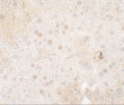 Invitrogen TMIGD1 Polyclonal Antibody 100 &mu;g; Unconjugated:Anticorps,