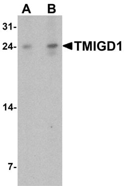 Invitrogen TMIGD1 Polyclonal Antibody 100 &mu;g; Unconjugated:Anticorps,