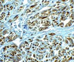 Invitrogen LRRC26 Polyclonal Antibody 100 &mu;g; Unconjugated:Antibodies,
