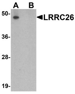 Invitrogen LRRC26 Polyclonal Antibody 100 &mu;g; Unconjugated:Antibodies,