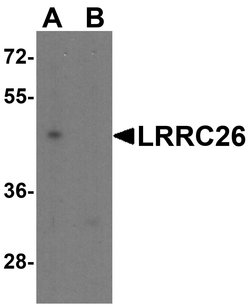 Invitrogen LRRC26 Polyclonal Antibody 100 &mu;g; Unconjugated:Antibodies,
