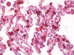 Invitrogen SFTPA1/SFTPA2 Polyclonal Antibody 100 &mu;g; Unconjugated:Antibodies,