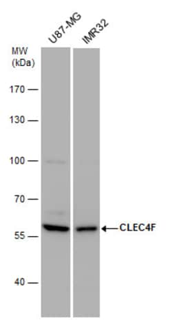 Invitrogen CLEC4F Polyclonal Antibody 100 &mu;L; Unconjugated:Antibodies,
