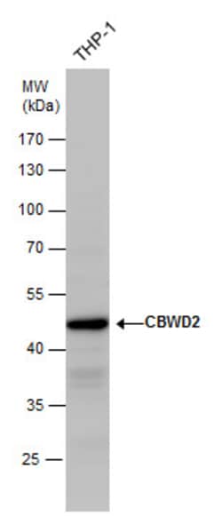 Invitrogen CBWD2 Polyclonal Antibody 100 &mu;L | Buy Online | Invitrogen&trade; | Fisher Scientific
