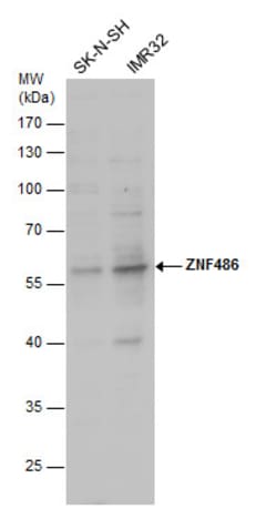 Invitrogen ZNF486 Polyclonal Antibody 100 &mu;L; Unconjugated:Antibodies,