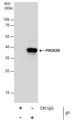 Invitrogen PHOX2B Polyclonal Antibody 100 &mu;L; Unconjugated:Antibodies,
