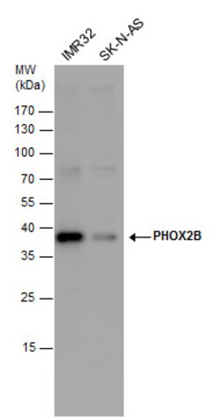 Invitrogen PHOX2B Polyclonal Antibody 100 &mu;L; Unconjugated:Antibodies,