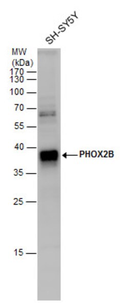 Invitrogen PHOX2B Polyclonal Antibody 100 &mu;L; Unconjugated:Antibodies,