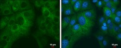 Invitrogen RPL32 Polyclonal Antibody 100 &mu;L; Unconjugated:Antibodies,