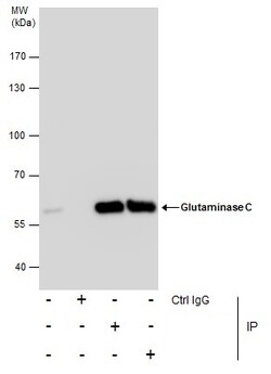 Invitrogen Glutaminase C (GAC) Polyclonal Antibody 100 &mu;L | Buy Online | Invitrogen&trade; | Fisher Scientific