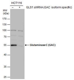 Invitrogen Glutaminase C (GAC) Polyclonal Antibody 100 &mu;L | Buy Online | Invitrogen&trade; | Fisher Scientific