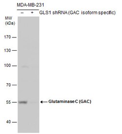 Invitrogen Glutaminase C (GAC) Polyclonal Antibody 100 &mu;L | Buy Online | Invitrogen&trade; | Fisher Scientific