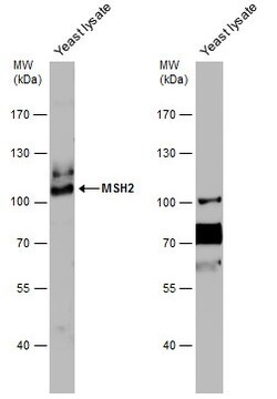 Invitrogen MSH2 Polyclonal Antibody 100 &mu;L; Unconjugated:Antibodies,