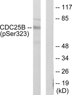 Invitrogen Phospho-Cdc25B (Ser323) Polyclonal Antibody 100 &mu;L | Buy Online | Invitrogen&trade; | Fisher Scientific