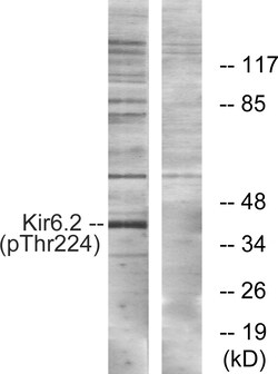Invitrogen Phospho-Kir6.2 (Thr224) Polyclonal Antibody 100 &mu;L; Unconjugated:Antibodies,