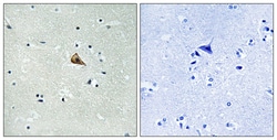 Invitrogen Phospho-TrkA (Tyr701) Polyclonal Antibody 100 &mu;L; Unconjugated:Antibodies,