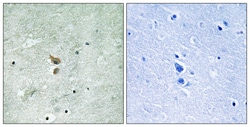 Invitrogen Phospho-RIP2 (Ser176) Polyclonal Antibody 100 &mu;L; Unconjugated:Antibodies,