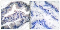 Invitrogen Phospho-BIK (Thr33) Polyclonal Antibody 100 &mu;L; Unconjugated:Antibodies,