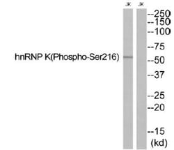 Invitrogen Phospho-hnRNP K (Ser216) Polyclonal Antibody 100 &mu;L | Buy Online | Invitrogen&trade; | Fisher Scientific