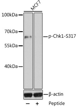 Invitrogen Phospho-CHK1 (Ser317) Polyclonal Antibody 100 &mu;L | Buy Online | Invitrogen&trade; | Fisher Scientific