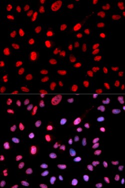 Invitrogen Phospho-DNMT1 (Ser714) Polyclonal Antibody 100 &mu;L; Unconjugated:Antibodies,