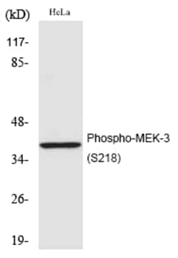 Invitrogen Phospho-MEK3 (Ser218) Polyclonal Antibody 100 &mu;L | Buy Online | Invitrogen&trade; | Fisher Scientific