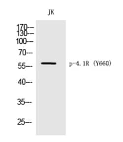 Invitrogen Phospho-EPB41 (Tyr660) Polyclonal Antibody 100 &mu;L; Unconjugated:Antibodies,