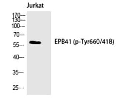 Invitrogen Phospho-EPB41 (Tyr660) Polyclonal Antibody 100 &mu;L; Unconjugated:Antibodies,