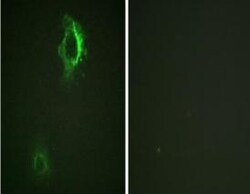 Invitrogen Phospho-CD5 (Tyr453) Polyclonal Antibody 100 &mu;L | Buy Online | Invitrogen&trade; | Fisher Scientific