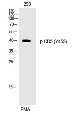 Invitrogen Phospho-CD5 (Tyr453) Polyclonal Antibody 100 &mu;L | Buy Online | Invitrogen&trade; | Fisher Scientific