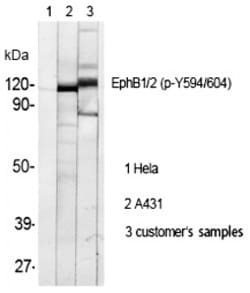 Invitrogen Phospho-EphB1/EphB2 (Tyr594, Tyr604) Polyclonal Antibody 100 &mu;L | Buy Online | Invitrogen&trade; | Fisher Scientific