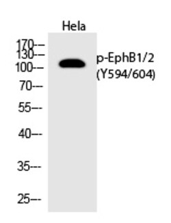 Invitrogen Phospho-EphB1/EphB2 (Tyr594, Tyr604) Polyclonal Antibody 100 &mu;L | Buy Online | Invitrogen&trade; | Fisher Scientific