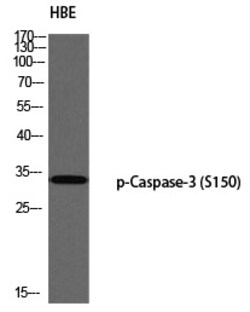 Invitrogen Phospho-Caspase 3 (Ser150) Polyclonal Antibody 100 &mu;L | Buy Online | Invitrogen&trade; | Fisher Scientific