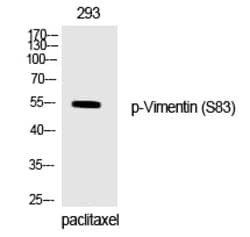 Invitrogen Phospho-Vimentin (Ser83) Polyclonal Antibody 100 &mu;L | Buy Online | Invitrogen&trade; | Fisher Scientific