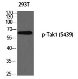 Invitrogen Phospho-TAK1 (Ser439) Polyclonal Antibody 100 &mu;L | Buy Online | Invitrogen&trade; | Fisher Scientific