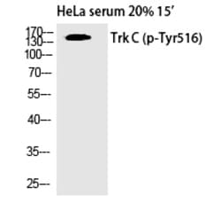 Invitrogen Phospho-TrkC (Tyr516) Polyclonal Antibody 100 &mu;L | Buy Online | Invitrogen&trade; | Fisher Scientific