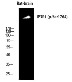 Invitrogen Phospho-IP3 Receptor 1 (Ser1764) Polyclonal Antibody 100 &mu;L | Buy Online | Invitrogen&trade; | Fisher Scientific