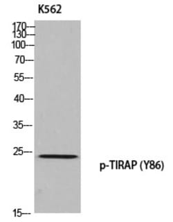 Invitrogen Phospho-TIRAP (Tyr86) Polyclonal Antibody 100 &mu;L | Buy Online | Invitrogen&trade; | Fisher Scientific