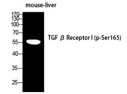 Invitrogen Phospho-TGFBR1 (Ser165) Polyclonal Antibody 100 &mu;L | Buy Online | Invitrogen&trade; | Fisher Scientific