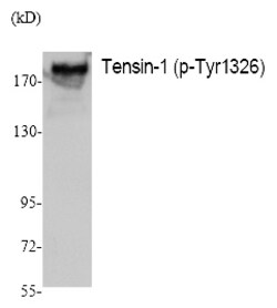 Invitrogen Phospho-Tensin 1 (Tyr1326) Polyclonal Antibody 100 &mu;L | Buy Online | Invitrogen&trade; | Fisher Scientific