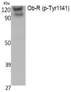 Invitrogen Phospho-Leptin Receptor (Tyr1141) Polyclonal Antibody 100 &mu;L;