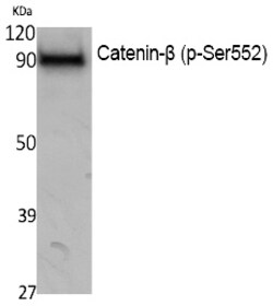 Invitrogen Phospho-beta Catenin (Ser552) Polyclonal Antibody 100 &mu;L | Buy Online | Invitrogen&trade; | Fisher Scientific