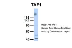 Invitrogen TAF1 Polyclonal Antibody 100 &mu;L; Unconjugated:Antibodies,