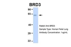 Invitrogen BRD3 Polyclonal Antibody 100 &mu;L; Unconjugated:Antibodies,