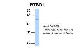 Invitrogen BTBD1 Polyclonal Antibody 100 &mu;L; Unconjugated:Antibodies,