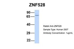 ZNF528 Polyclonal Antibody:Antibodies, Polyclonal