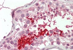 BRDT Polyclonal Antibody:Antibodies, Polyclonal