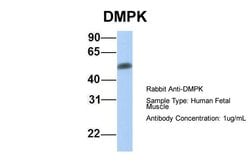 Invitrogen DMPK Polyclonal Antibody 100 &mu;L; Unconjugated:Antibodies,
