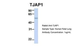 Invitrogen TJAP1 Polyclonal Antibody 100 &mu;L; Unconjugated:Antibodies,