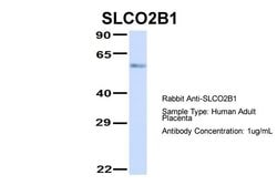 Invitrogen SLCO2B1 Polyclonal Antibody 100 &mu;L; Unconjugated:Antibodies,